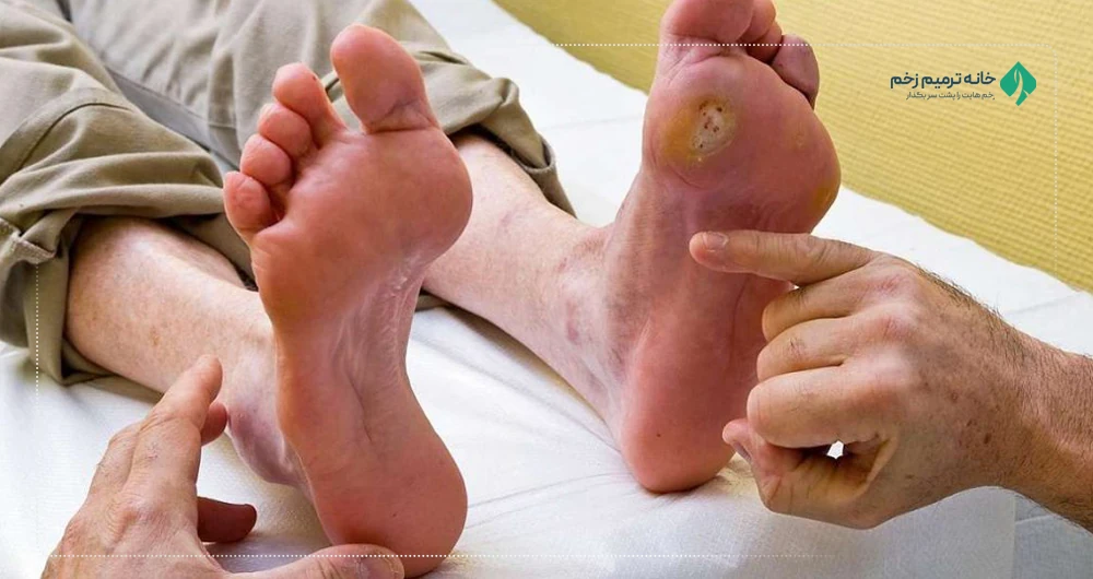آسیب پذیری زخم سالمندان