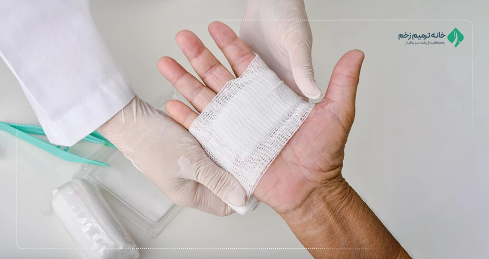انواع پاسنمان پیشرفته زخم دیابتی