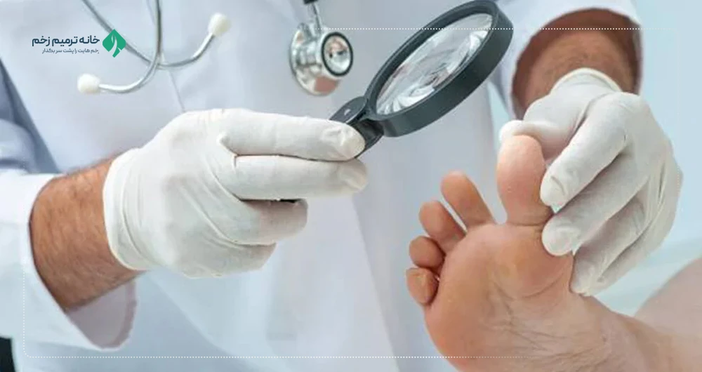 مراقبت از زخم پای دیابتی