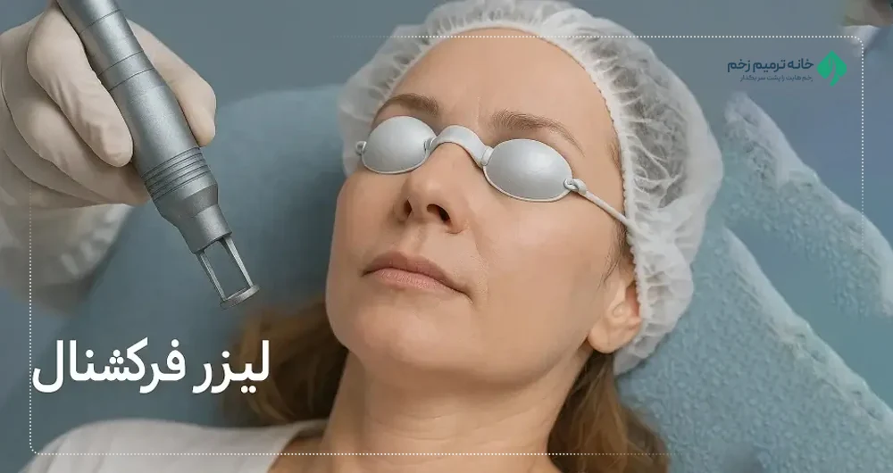 لیزر CO₂ فرکشنال