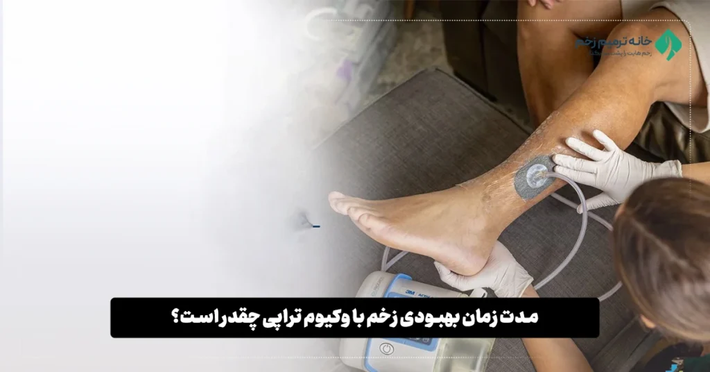 مدت زمان بهبودی زخم با وکیوم تراپی چقدر است؟ | کلینیک خانه ترمیم زخم مشهد