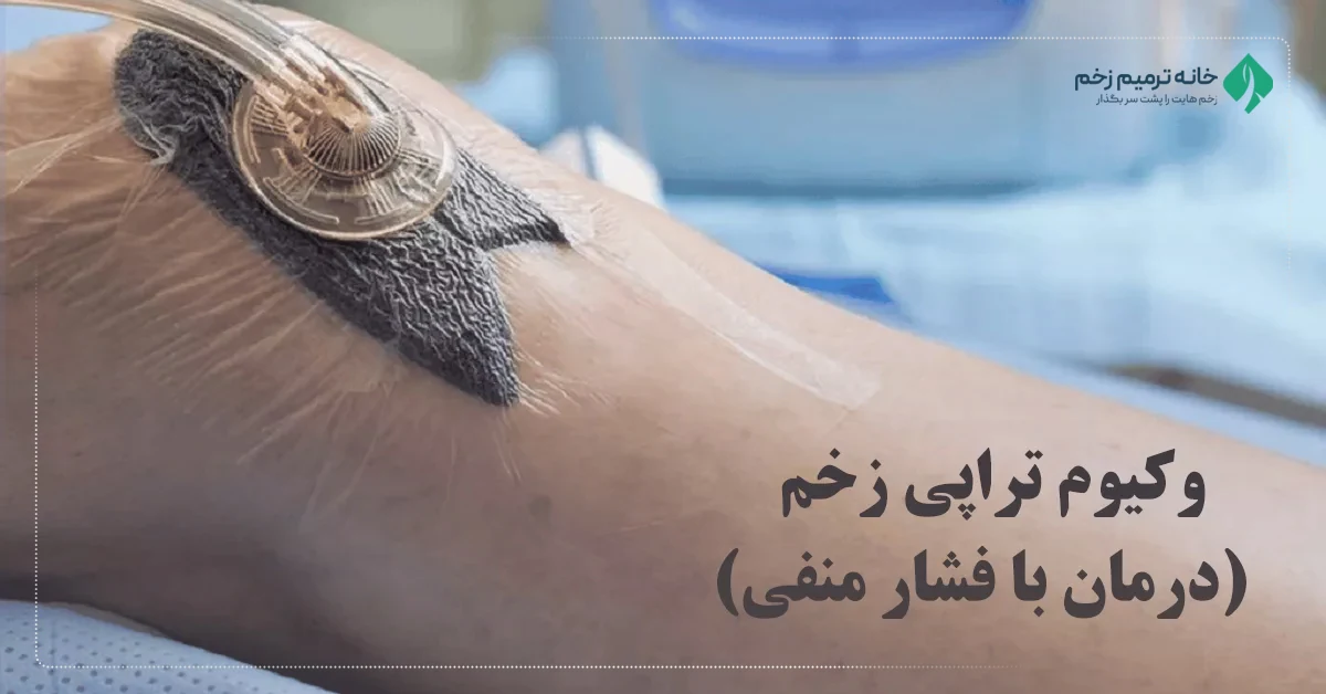 چقدر طول میکشد زخم با وکیوم تراپی خوب شود؟