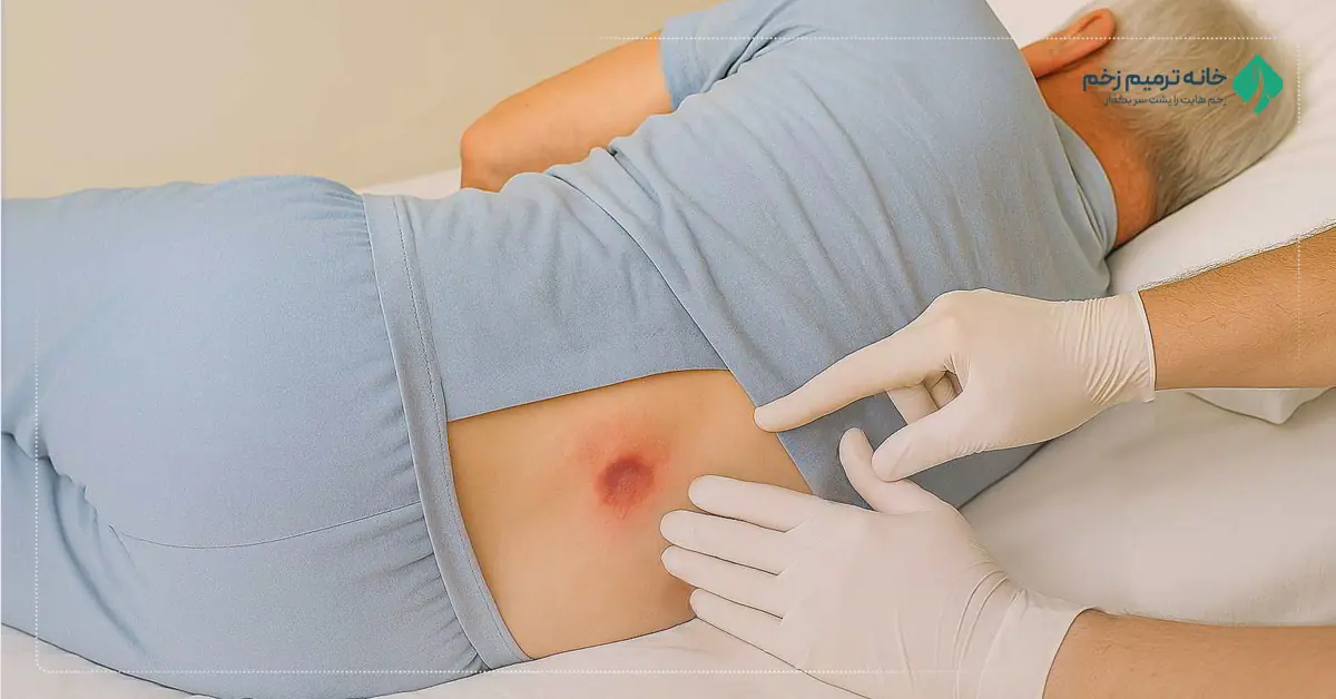 ۹ علامت حیاتی عفونت در زخم دیابتی