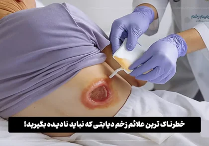 خطرناک ترین علائم زخم دیابتی که نباید نادیده بگیرید!