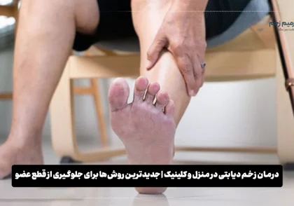 درمان زخم دیابتی