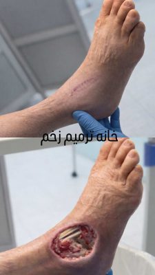 IMG_20260614_164655_422_38725e1a_6a2eabea60d4f4.68484714_572963_1781443562_compressed